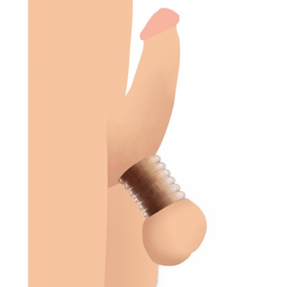 Picture of Ring Master Custom Ball Stretcher Kit