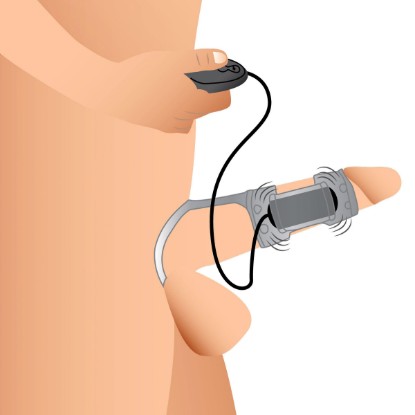 Picture of 20X Dual Cock Teaser with Cock and Ball Ring