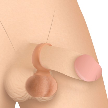 Picture of 28X Vibrating Realistic Balls with Remote - 35mm